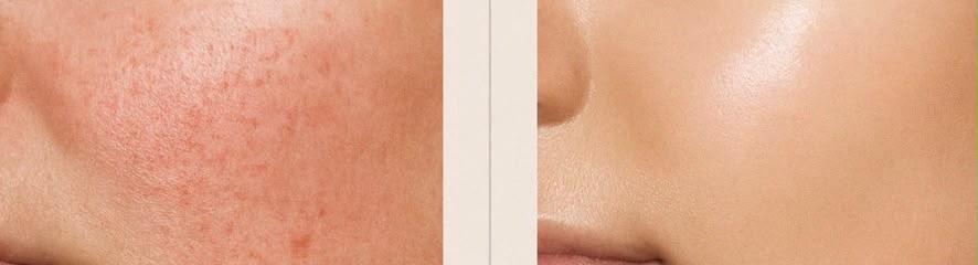 Your Skin Is Not Misbehaving, It Is Communicating